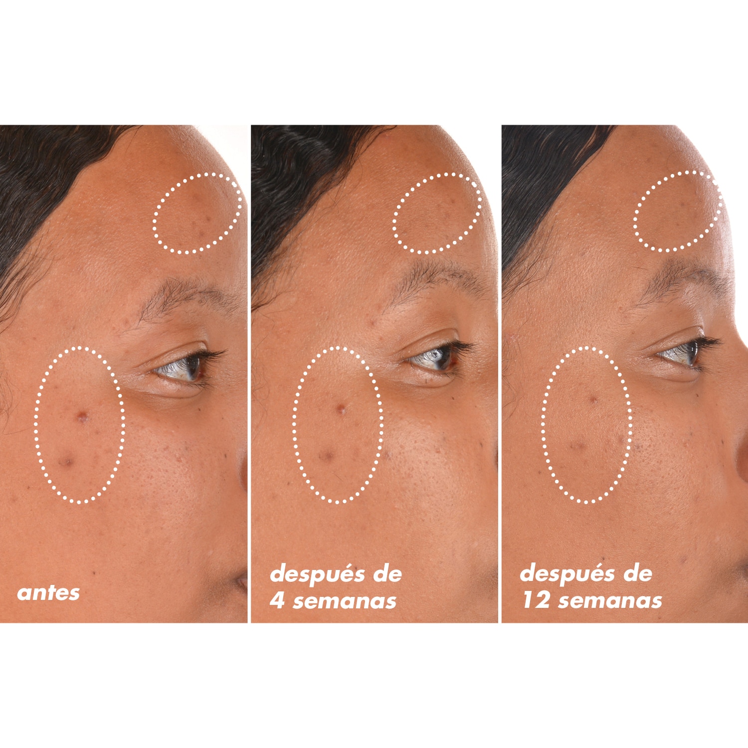 E.L.F. SKIN BRIGHT ICON VITAMIN C + E + FERULIC SERUM (SÉRUM FACIAL ILUMINADOR)